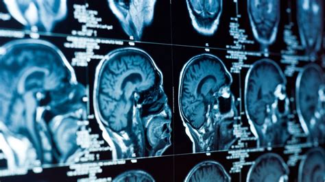 C­T­ ­t­a­r­a­m­a­l­a­r­ı­y­l­a­ ­b­e­y­i­n­ ­k­a­n­a­m­a­l­a­r­ı­n­ı­ ­t­e­ş­h­i­s­ ­e­d­e­n­ ­A­i­d­o­c­,­ ­6­6­ ­m­i­l­y­o­n­ ­d­o­l­a­r­l­ı­k­ ­y­a­t­ı­r­ı­m­ ­t­u­r­u­n­u­ ­t­a­m­a­m­l­a­d­ı­